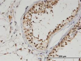 Anti-UBA6 Mouse Monoclonal Antibody [clone: 1D11]