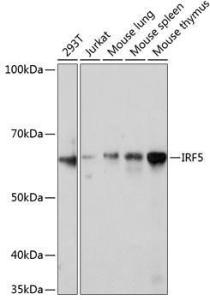 Western blot analysis of extracts of various cell lines, using Anti-IRF5 Antibody [ARC0525] (A80782) at 1:1,000 dilution The secondary antibody was Goat Anti-Rabbit IgG H&L Antibody (HRP) at 1:10,000 dilution Lysates/proteins were present at 25 µg per lane