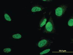 Anti-UBA6 Mouse Monoclonal Antibody [clone: 1D11]