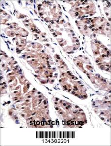 Anti-RUNX3 Rabbit Polyclonal Antibody