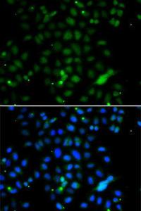 Immunofluorescence analysis of A549 cells using Anti-ELF4 Antibody (A7180). Blue: DAPI for nuclear staining.