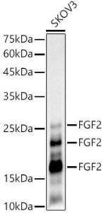 Western blot analysis of SKOV3, using Anti-FGF2 Antibody [ARC51110] (A308409) at 1:1,000 dilution