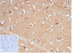 Immunohistochemical analysis of formalin-fixed, paraffin-embedded human brain using Anti-AKR1B1 Antibody [AKR1B1/7009R] at 2 µg/ml in PBS for 30 minutes at room temperature. Inset: PBS instead of the primary antibody. Secondary antibody negative control