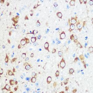 Anti-Mint-1 Rabbit Polyclonal Antibody