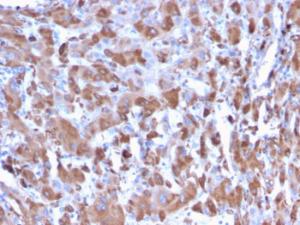 Immunohistochemical analysis of formalin-fixed, paraffin-embedded human liver using Anti-C1QA Antibody [C1QA/2953]