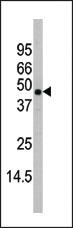 Anti-MAPK11 Rabbit Polyclonal Antibody