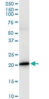 Anti-IL17C Polyclonal Antibody Pair