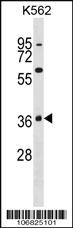 Anti-MAPK11 Rabbit Polyclonal Antibody