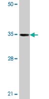 Anti-TIRAP Rabbit Polyclonal Antibody