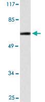 Anti-PSEN1 Rabbit Polyclonal Antibody