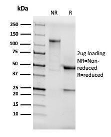 SDS-PAGE analysis of Anti-AKT1 Antibody [AKT1/3898R] under non-reduced and reduced conditions; showing intact IgG and intact heavy and light chains, respectively. SDS-PAGE analysis confirms the integrity and purity of the antibody.