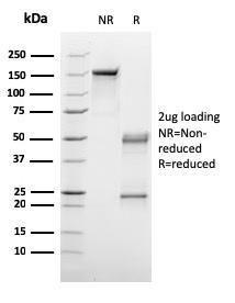 SDS-PAGE analysis of Anti-C1QA Antibody [C1QA/2953] under non-reduced and reduced conditions; showing intact IgG and intact heavy and light chains, respectively. SDS-PAGE analysis confirms the integrity and purity of the antibody