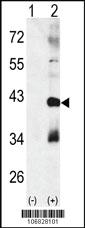 Anti-MAPK11 Rabbit Polyclonal Antibody