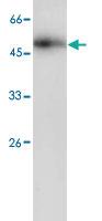 Anti-SERPINE1 Mouse Monoclonal Antibody [clone: 10]