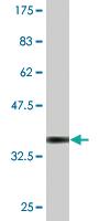 Anti-ESD Mouse Monoclonal Antibody [clone: 1E1]