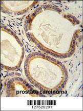 Anti-TRAM2 Rabbit Polyclonal Antibody (FITC (Fluorescein Isothiocyanate))