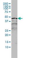 Anti-RARA Mouse Monoclonal Antibody [clone: 2C9-1F8]