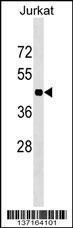 Anti-HOXC10 Rabbit Polyclonal Antibody (Biotin)