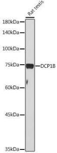 Western blot analysis of extracts of Rat testis, using Anti-DCP1B Antibody (A308410) at 1:1,000 dilution