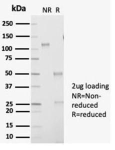 SDS-PAGE analysis of Anti-AKR1B1 Antibody [AKR1B1/7009R] under non-reduced and reduced conditions; showing intact IgG and intact heavy and light chains, respectively. SDS-PAGE analysis confirms the integrity and purity of the antibody