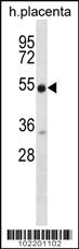 Anti-LZTS2 Rabbit Polyclonal Antibody