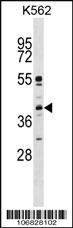 Anti-MAPK11 Rabbit Polyclonal Antibody