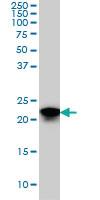 Anti-SRSF3 Mouse Monoclonal Antibody [clone: 2D2]