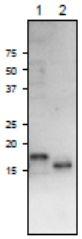 Anti-Ferredoxin-3 Rabbit Polyclonal Antibody