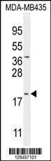 Anti-CT173 Rabbit Polyclonal Antibody (Biotin)