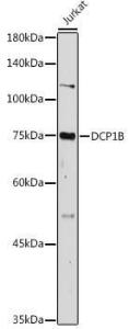 Western blot analysis of extracts of Jurkat cells, using Anti-DCP1B Antibody (A308410) at 1:1,000 dilution