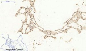 Immunohistochemical analysis of paraffin-embedded human lung tissue using Anti-Ki67 Antibody at 1:200 (4°C overnight). Negative control was secondary antibody only.