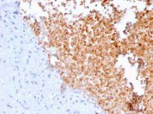 Immunohistochemical analysis of formalin-fixed, paraffin-embedded human lung using Anti-alpha Fodrin Antibody [SPTAN1/3352]