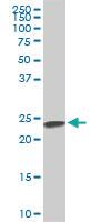 Anti-SRSF3 Mouse Monoclonal Antibody [clone: 2D2]