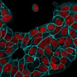 Immunofluorescent analysis of MCF-7 cells stained with Anti-EpCAM Antibody [EGP40/1556R] followed by Goat Anti-Rabbit IgG (CF&#174; 488) (Cyan). Nuclei counterstained with RedDot (Red).