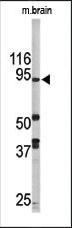 Anti-KDM1A Rabbit Polyclonal Antibody