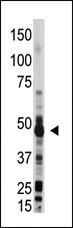 Anti-OAS1 Rabbit Polyclonal Antibody