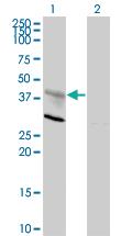 Anti-CXCR4 Mouse Monoclonal Antibody [clone: 2H5]