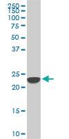 Anti-SRSF3 Mouse Monoclonal Antibody [clone: 2D2]