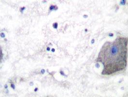 Anti-PSEN1 Rabbit Polyclonal Antibody