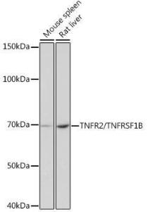 Western blot analysis of extracts of various cell lines, using Anti-TNF Receptor II Antibody [ARC0397] (A308412) at 1:1,000 dilution. The secondary antibody was Goat Anti-Rabbit IgG H&L Antibody (HRP) at 1:10,000 dilution.