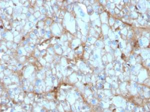 Immunohistochemical analysis of formalin-fixed, paraffin-embedded human kidney using Anti-C1QA Antibody [C1QA/2954]