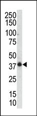 Anti-MAPK12 Rabbit Polyclonal Antibody