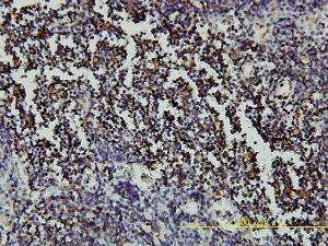 Anti-RARA Mouse Monoclonal Antibody [clone: 2C9-1F8]