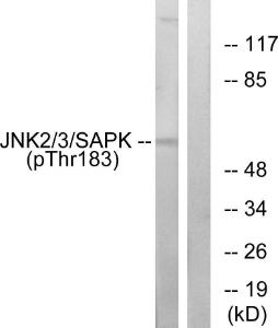 Antibody anti-SAPK phospho THR183 100 µg