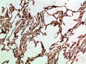 Immunohistochemical analysis of paraffin-embedded human lung using Anti-ADI1 Antibody