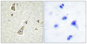 Immunohistochemical analysis of paraffin-embedded human brain tissue using Anti-PCDH X + PCDH Y Antibody. The right hand panel represents a negative control, where the antibody was pre-incubated with the immunising peptide