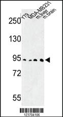 Anti-DPP10 Rabbit Polyclonal Antibody