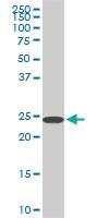 Anti-SRSF3 Mouse Monoclonal Antibody [clone: 2D2]