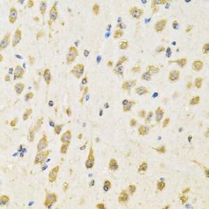 Immunohistochemistry analysis of paraffin-embedded mouse brain using Anti-PTPRE Antibody (A10085) at a dilution of 1:100 (40X lens). Perform microwave antigen retrieval with 10 mM PBS buffer pH 7.2 before commencing with IHC staining protocol