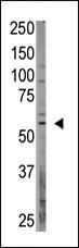 Anti-CREB3L1 Rabbit Polyclonal Antibody